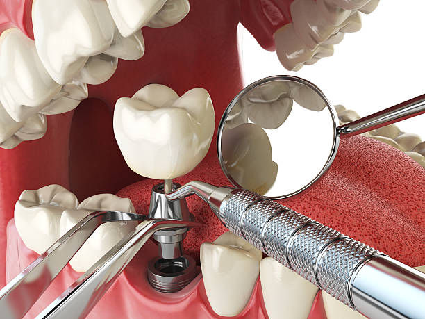 Best Holiday Emergency Dentist in University Of Pittsburgh Johnstown, PA